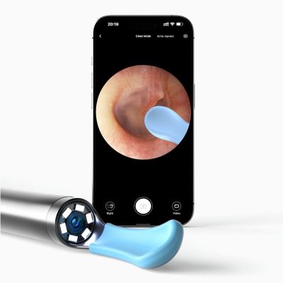 3. Bebird R1+ Weiß | Otoskop mit Kamera zur Ohrreinigung | 1080p, 180 mAh