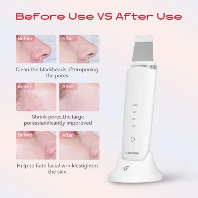 9. MAXGROOM M-169 Ultraschall-Kavitationspeelinggerät mit LED-Lichttherapie – weiß