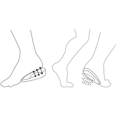 12. UMBRO GEL-FERSENEINLAGEN GRÖSSE 38-41