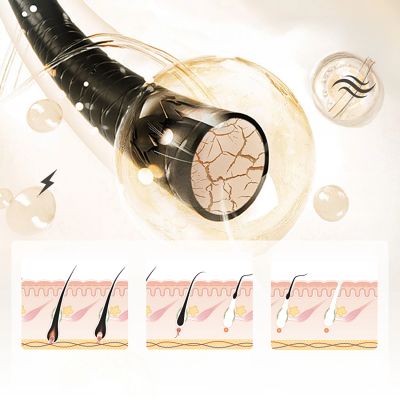 4. MAXGROOM JD-TM003 IPL-Epilierer zur Haarentfernung – weiß und rosa